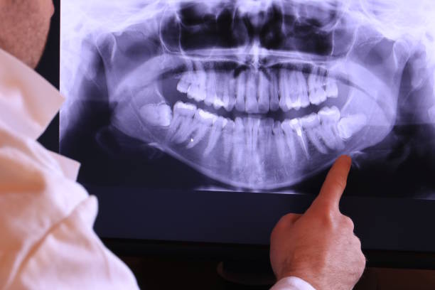 Best Emergency Tooth Extraction in Tinton Falls, NJ